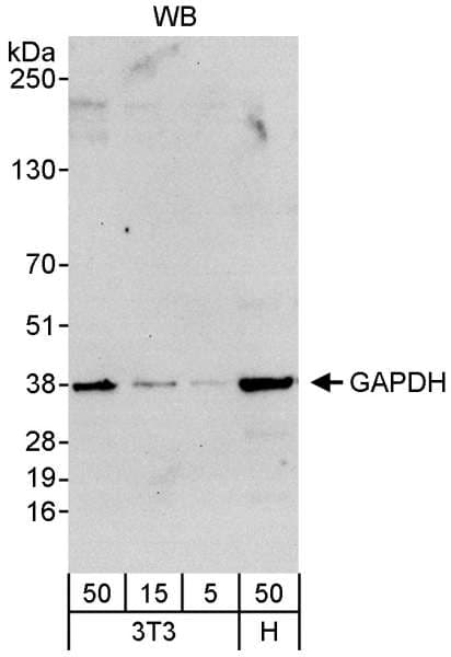 Polyclonal Rabbit anti-Human GAPDH Antibody (aa150-200, IHC, WB)