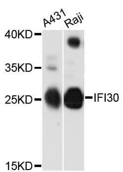 IFI30 / IP30 Antibody