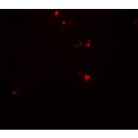 IHC-plus™ Polyclonal Rabbit anti-Human DTX4 Antibody (IHC, IF, WB)