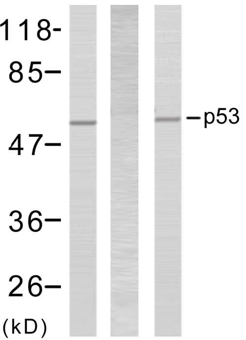 Polyclonal Rabbit anti-Human TP53 / p53 Antibody (p6, IHC, WB)