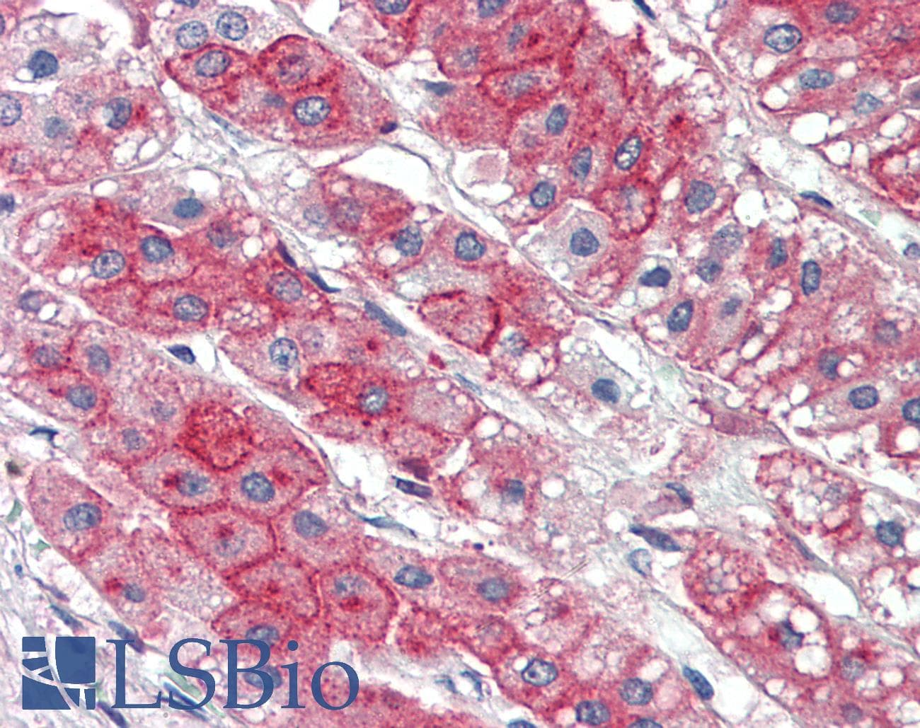 IHC-plus™ Polyclonal Rabbit anti-Human KIAA1324 / maba1 Antibody (Internal)