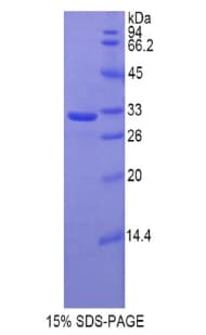 Rat HAS1 / HAS Protein (Recombinant His)