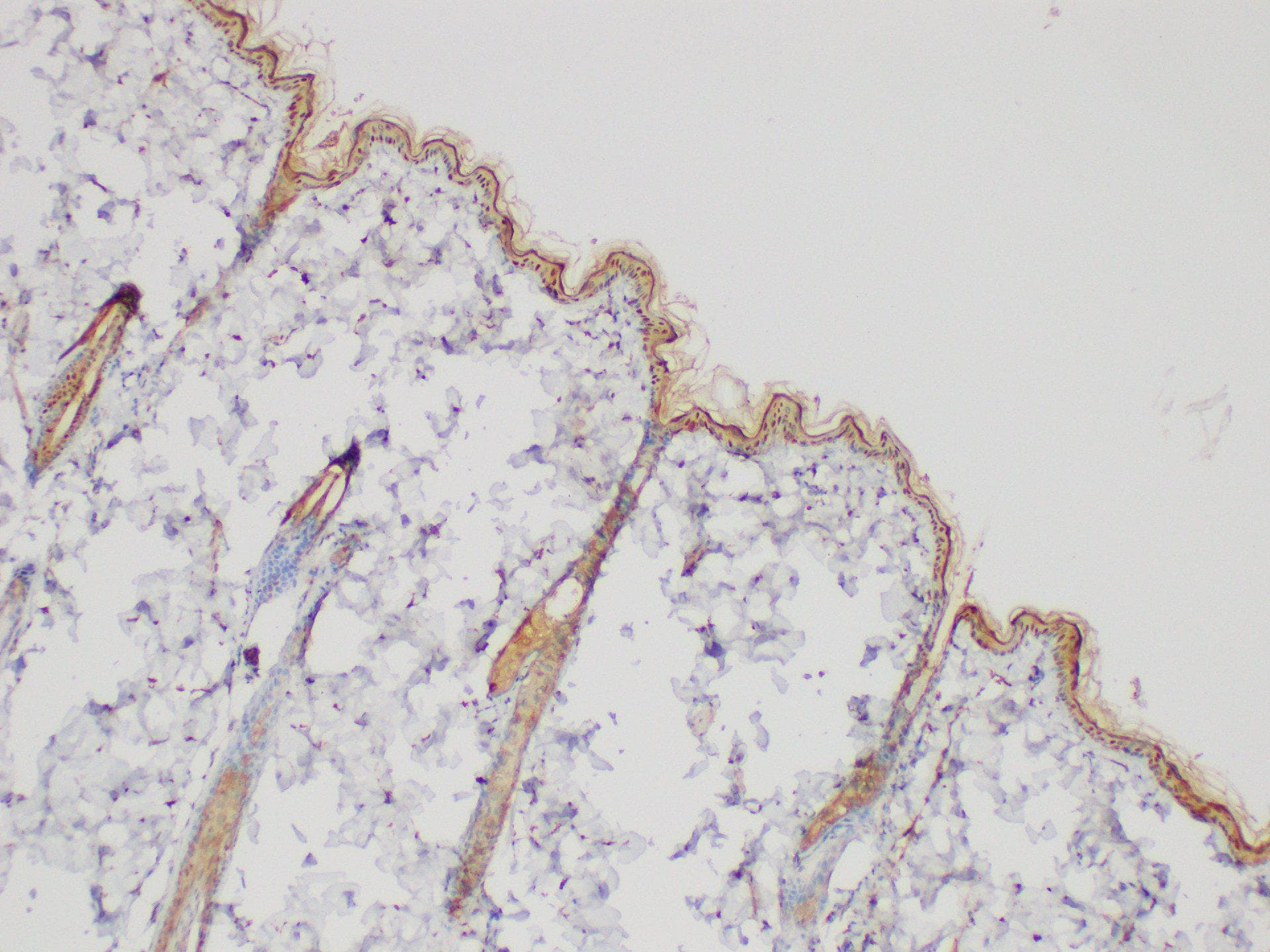 SERPINB2 / PAI-2 Antibody