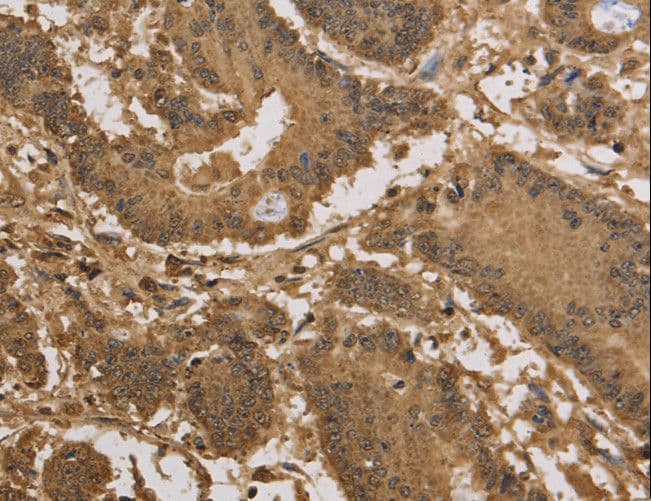 KDM5B / JARID1B Antibody