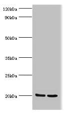 Polyclonal Rabbit anti-Human GLO1 / Glyoxalase I Antibody (aa1-184, IHC, WB)