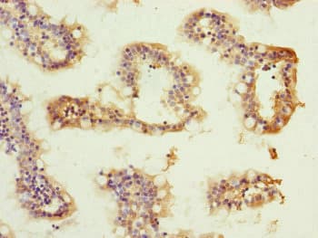Polyclonal Rabbit anti-Human ATP5H Antibody (IHC, WB)