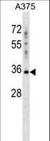 PSG2 Antibody (aa225-254)