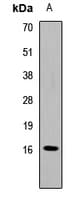 Polyclonal Rabbit anti-Human BIRC5 / Survivin Antibody (IF, WB)