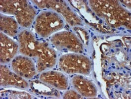 PDSS2 / DLP1 Antibody (clone OTI1D10)