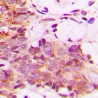 CNTROB Antibody (Internal)