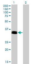 PHOX2A Antibody (clone 4F6)