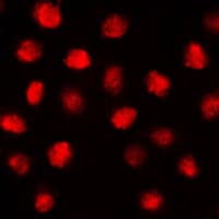 ZIF268 / EGR1 Antibody (C-Terminus)