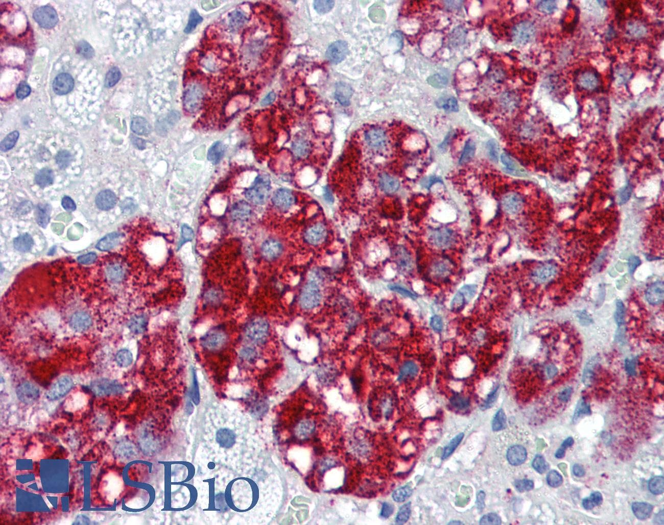 IHC-plus™ CTNND1 / p120 Catenin Antibody (C-Terminus)