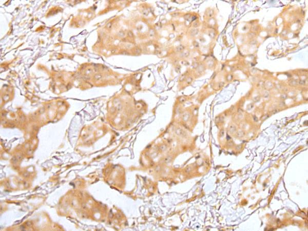 GRAP Antibody