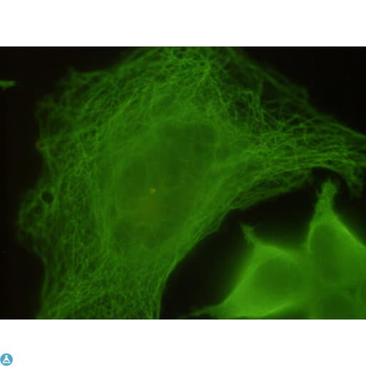 TUBB / Beta Tubulin Antibody