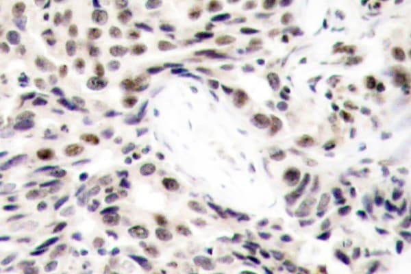 RELA / NFKB p65 Antibody (Leu523)