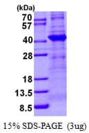 Human TBCC Protein (Recombinant His)