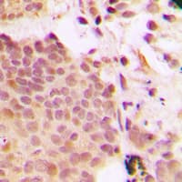 G3BP1 / G3BP Antibody (phospho-Ser232)