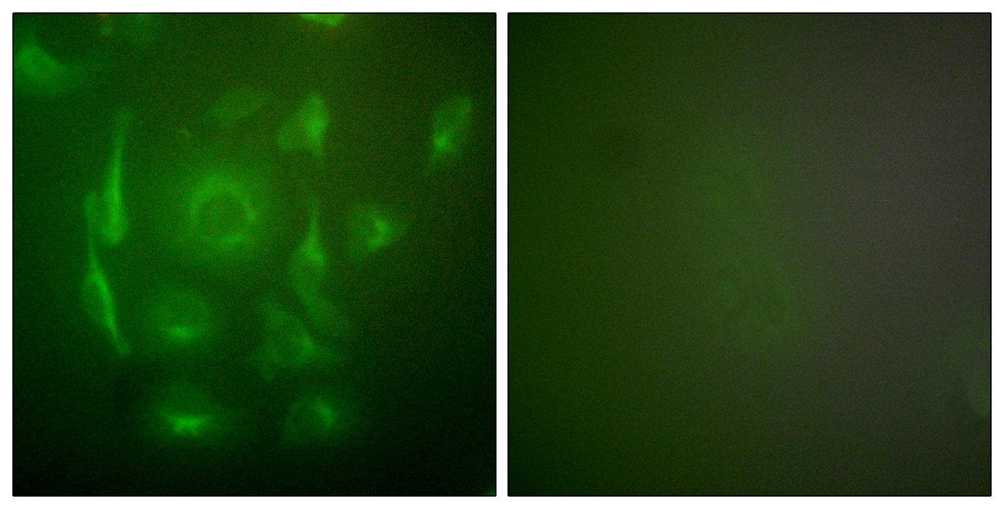 KRT7 / CK7 / Cytokeratin 7 Antibody