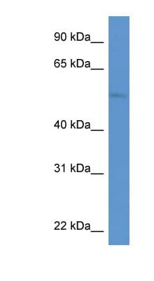 ZIC3 Antibody (aa93-142)