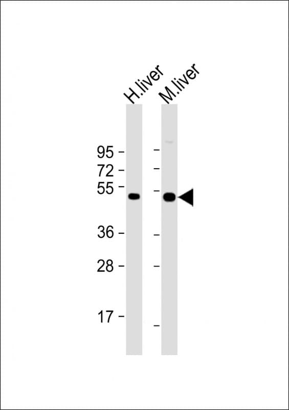 Polyclonal Rabbit anti-Human CTBS / CTB Antibody (Internal, WB)