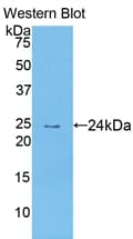 CCL25 / TECK Antibody (aa24-150, HRP)