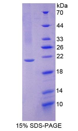 Human UBE2L3 / UBCH7 Protein (Recombinant His-S)