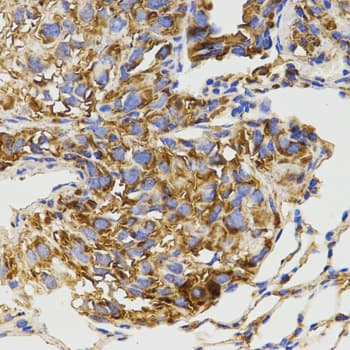 GRM8 / MGLUR8 Antibody