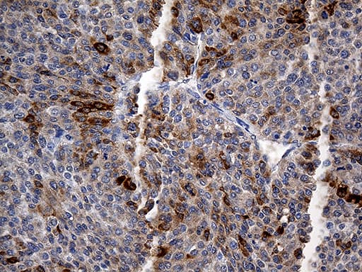 Monoclonal Mouse anti-Human TFF1 / pS2 Antibody (clone OTI2C8, aa25-84, IHC)