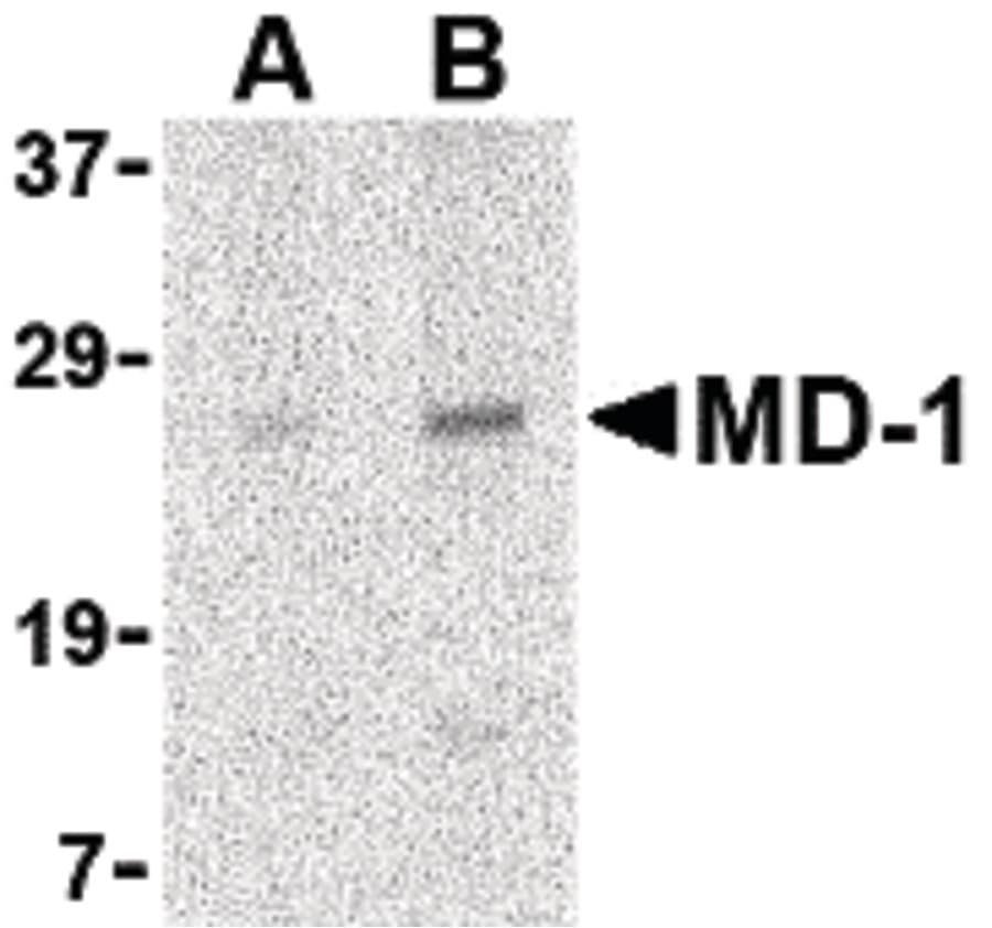 IHC-plus™ MD-1 / LY86 Antibody