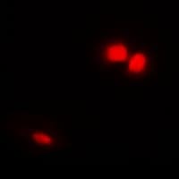 EMD / Emerin Antibody