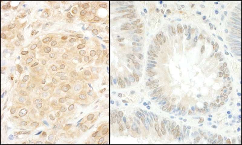 Polyclonal Rabbit anti-Human MAP2K1 / MKK1 / MEK1 Antibody (aa343-393, IHC, WB)
