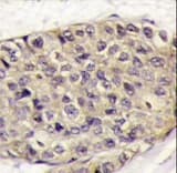 Polyclonal Rabbit anti-Human VEGFA / VEGF Antibody (IHC, WB)