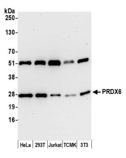 PRDX6 / Peroxiredoxin 6 Antibody (aa50-100)