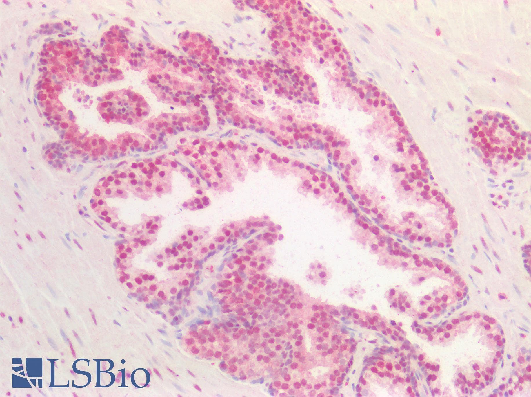 IHC-plus™ Polyclonal Goat anti-Human BMI1 / PCGF4 Antibody (aa237-251, IHC, WB)