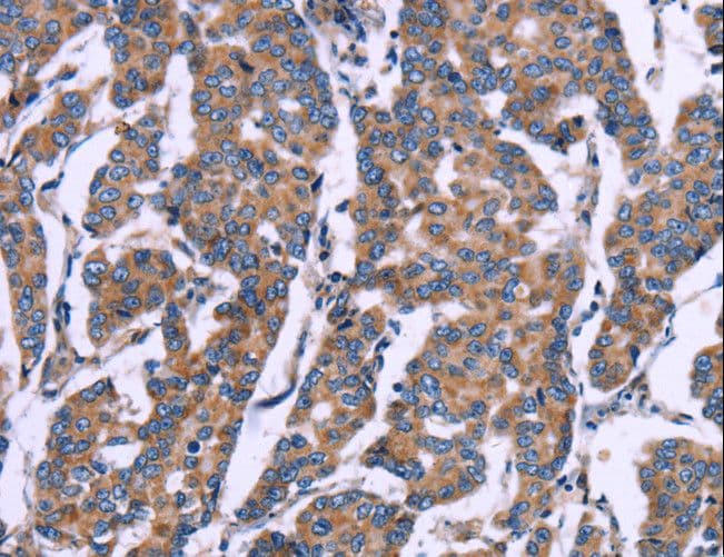 ZEB2 / SIP-1 Antibody