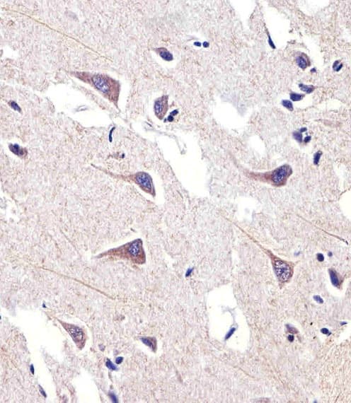Polyclonal Rabbit anti-Human Delta-6 Desaturase / FADS2 Antibody (aa96-122, IHC, WB)