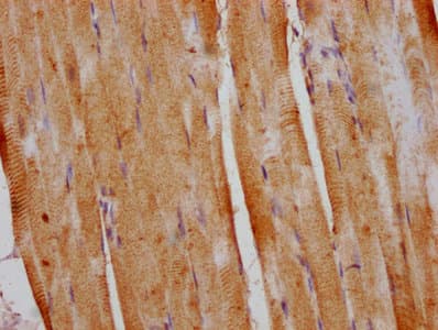 DUSP13 Antibody
