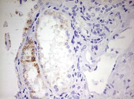 EHHADH / Enoyl-Coa Hydratase Antibody (aa496-723, clone OTI2C4, Carrier-free)
