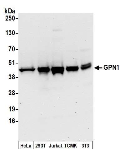 Polyclonal Rabbit anti-Human GPN1 / XAB1 Antibody (aa325-375, WB)