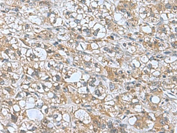 Polyclonal Rabbit anti-Human KANSL1L Antibody (IHC)