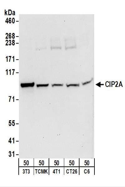KIAA1524 / p90 Autoantigen Antibody (aa853-903)