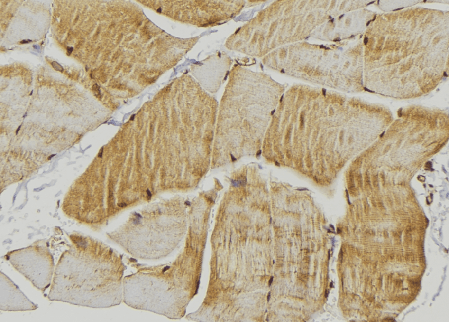 ADRB2 Antibody (phospho-Ser346)