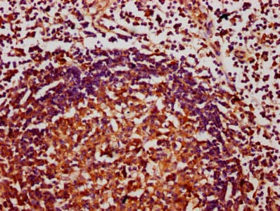 Polyclonal Rabbit anti-Human CHAF1A / CAF1 Antibody (IHC)