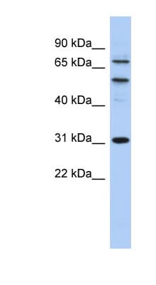 FACT / SSRP1 Antibody (aa503-552)
