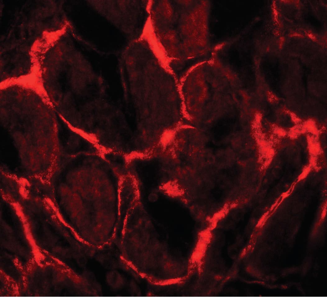 IHC-plus™ CD135 / FLT3 Antibody