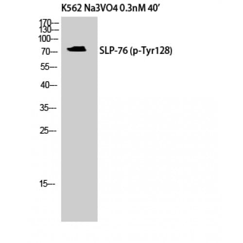 LCP2 / SLP-76 Antibody (70-150 aa)