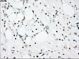 PLK1 / PLK-1 Antibody (clone OTI1A2)