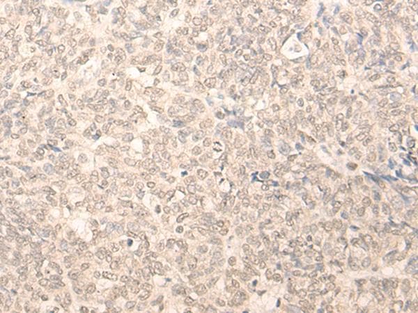 Polyclonal Rabbit anti-Human TIP48 / RUVBL2 Antibody (IHC)