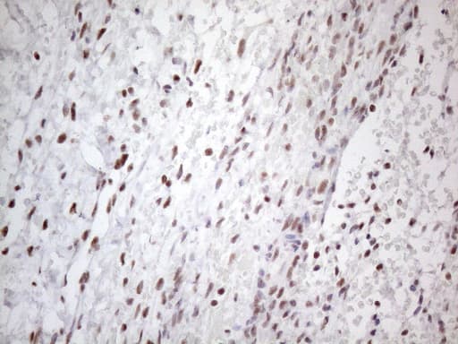 TP53BP1 / 53BP1 Antibody (aa1-300, clone OTI5E1)